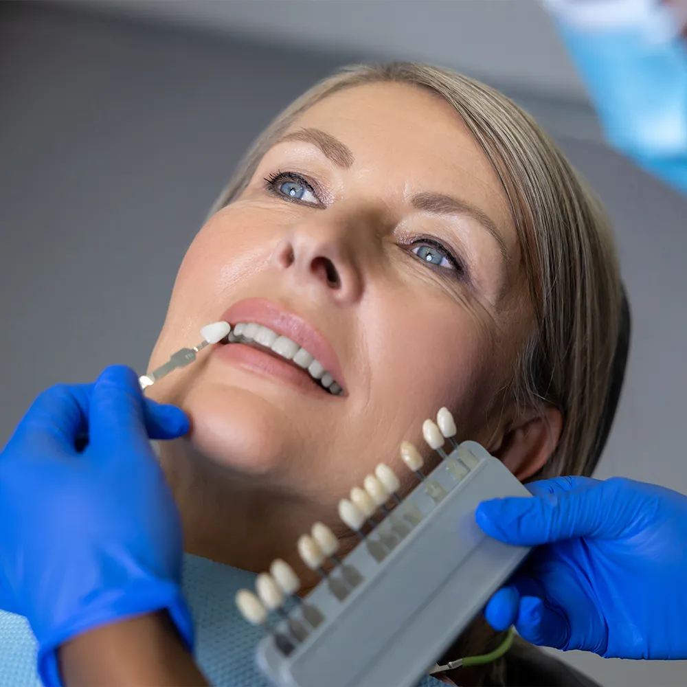 Dentist matching teeth shade with color chart.