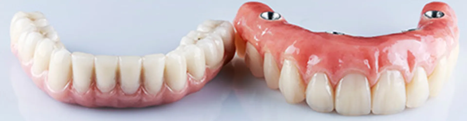 upper and lower permanent dentures.