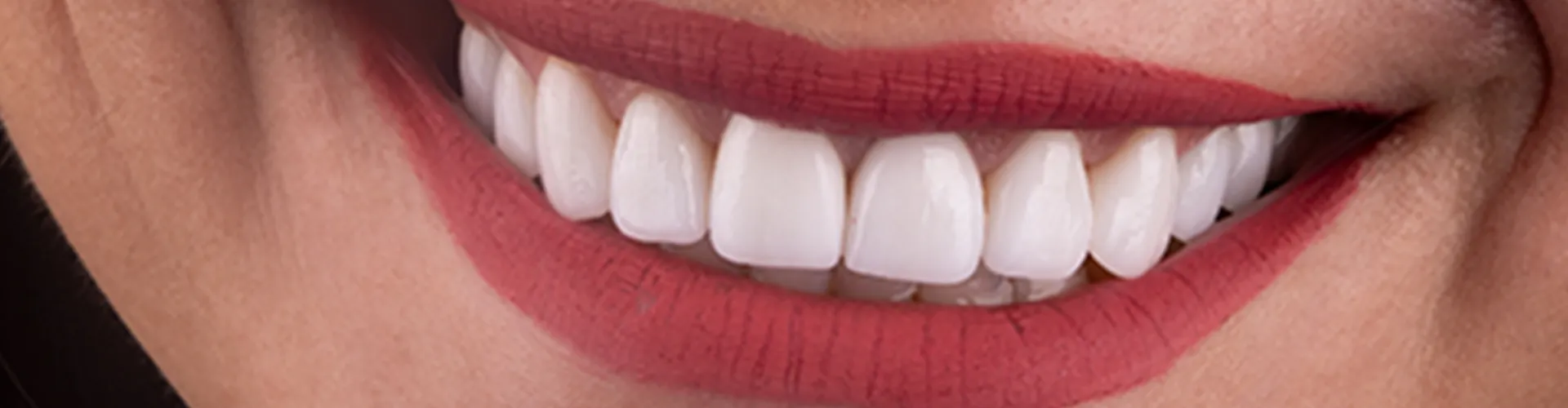 Close-up of womans smile.