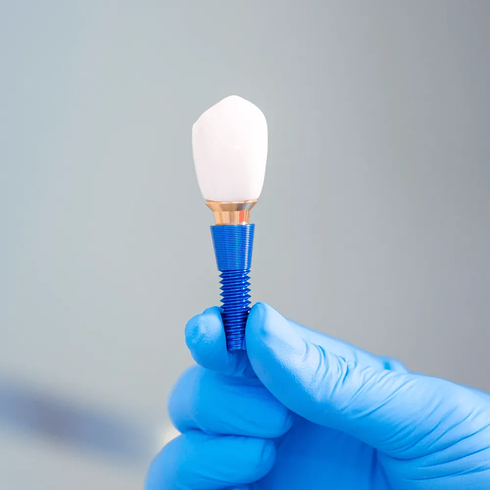 Close-up of a dental implant crown and abutment held by gloved hands.