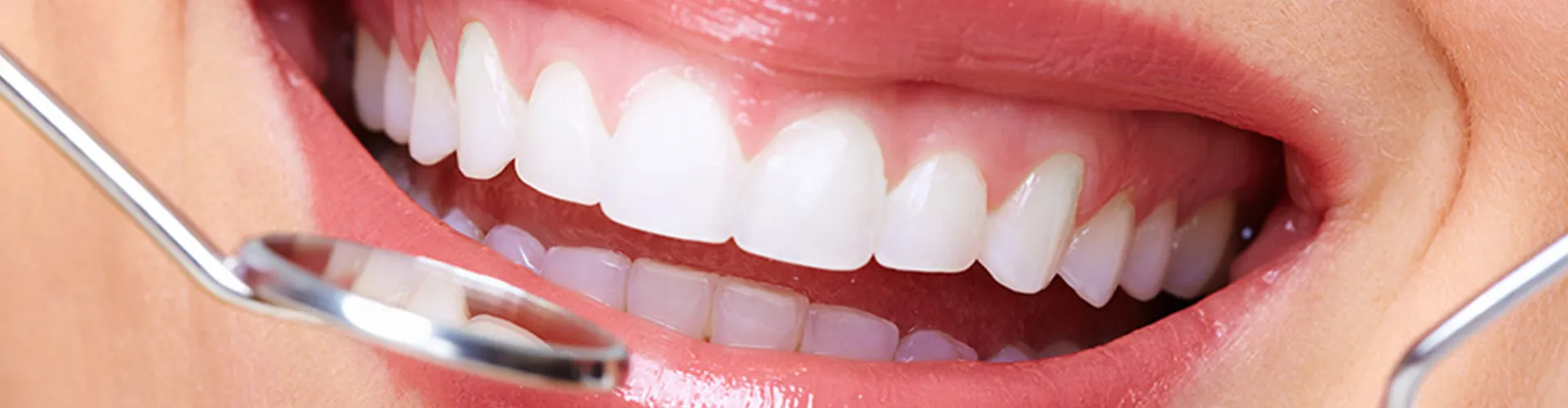 Close up of a woman smiling.