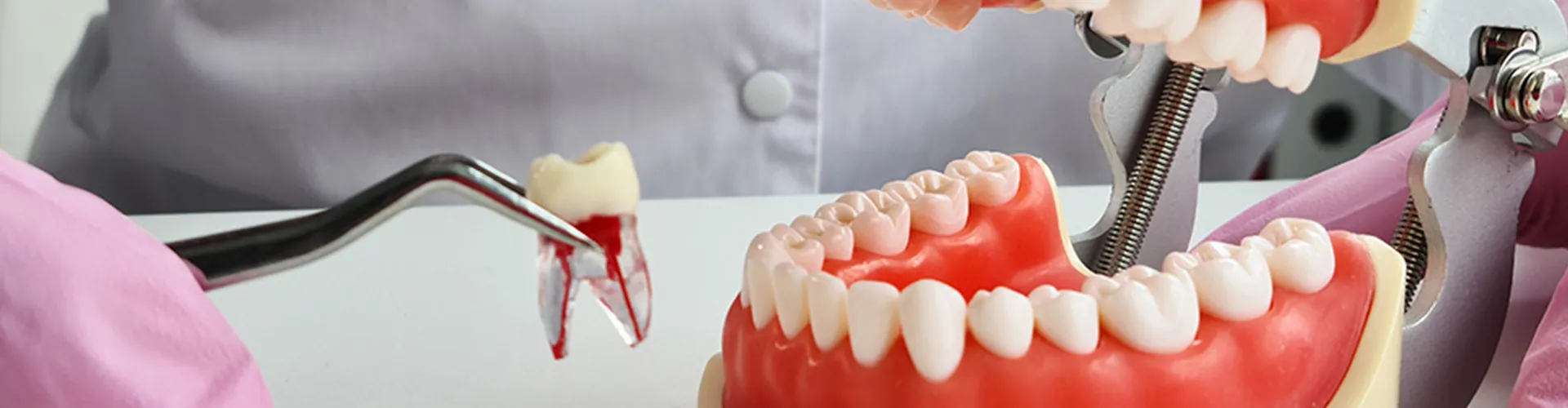 Dentist using denture model to demonstrate tooth extraction with fake tooth.