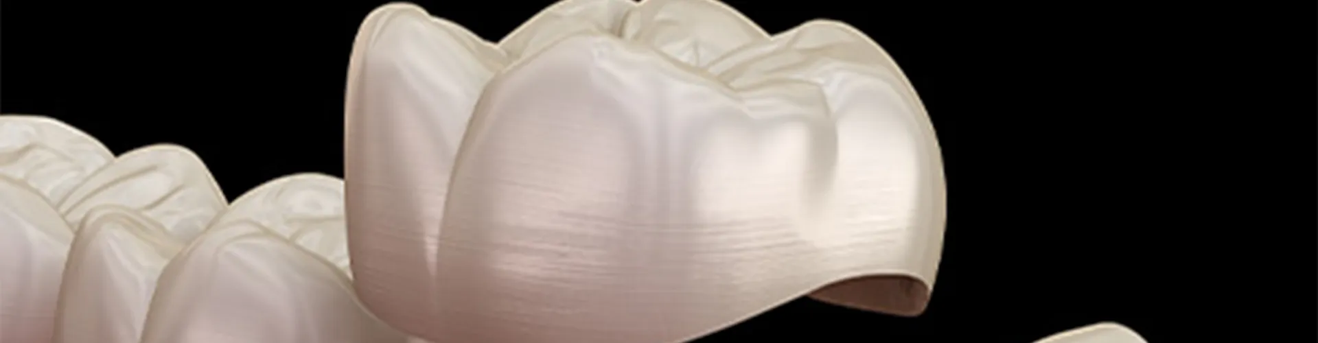 3D illustration of a dental crown.