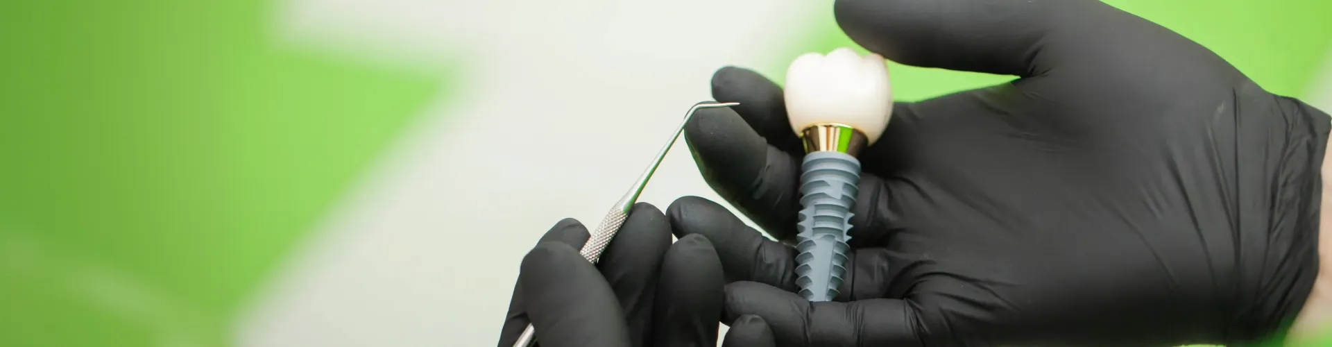 Dental implant model held in black-gloved hands.