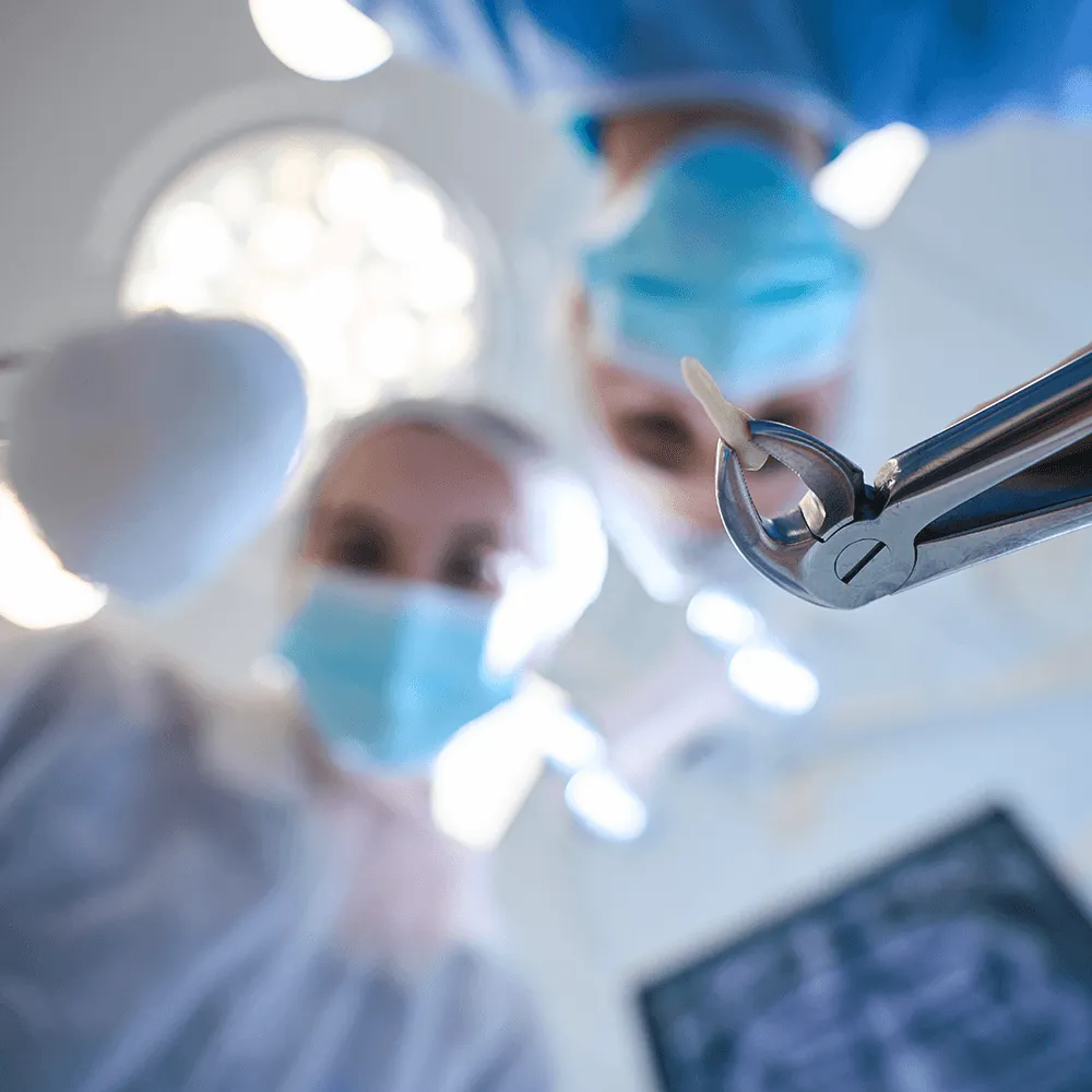 Close-up of forceps holding extracted tooth during oral surgery.