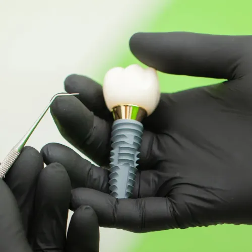 Dental implant model held in black-gloved hands.