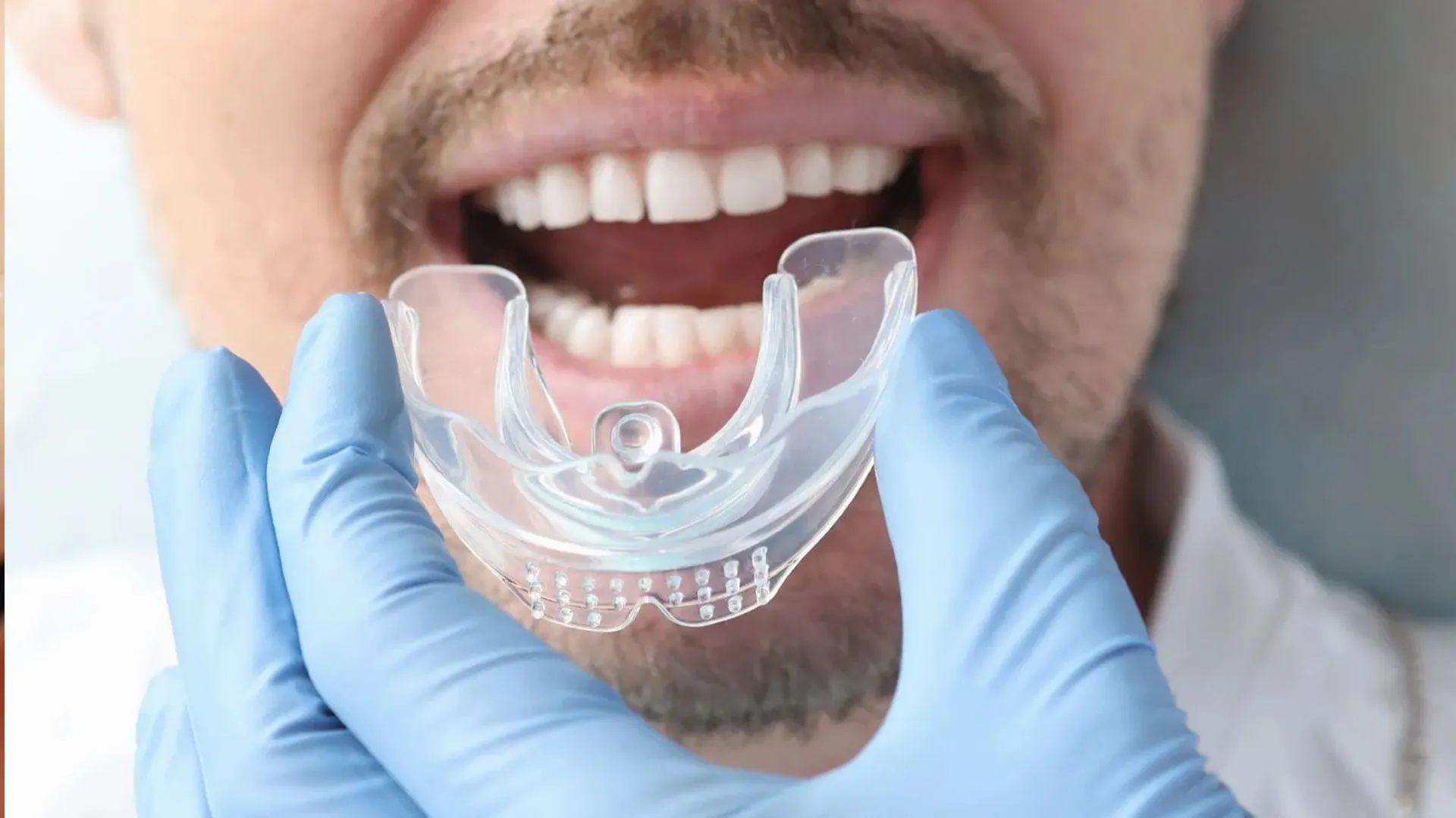 Man holding oral appliance for sleep apnea.