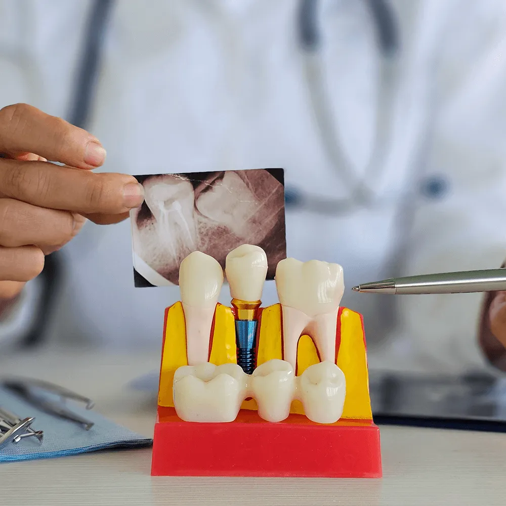 Dentist showing dental implant model and x-ray.