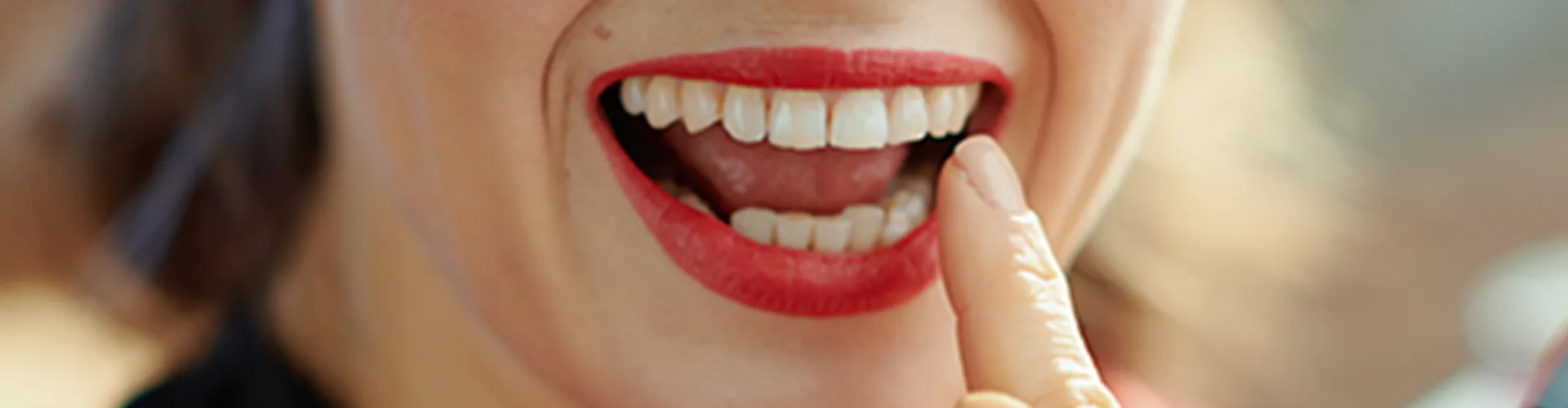 Smiling woman pointing at teeth.