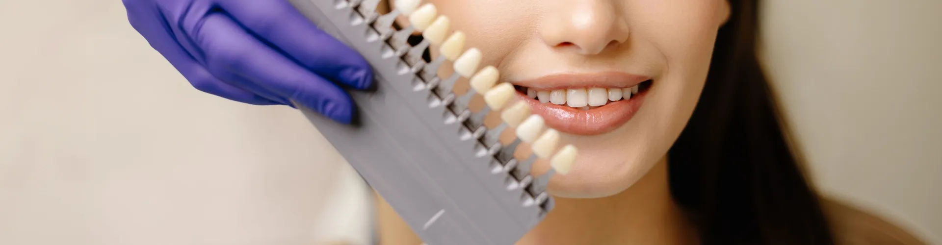 Dental professional holding a shade guide next to a smiling patient’s teeth.