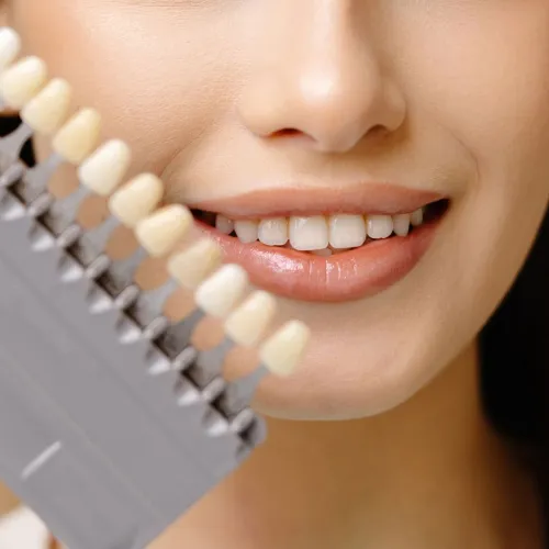 Dental professional holding a shade guide next to a smiling patient’s teeth.