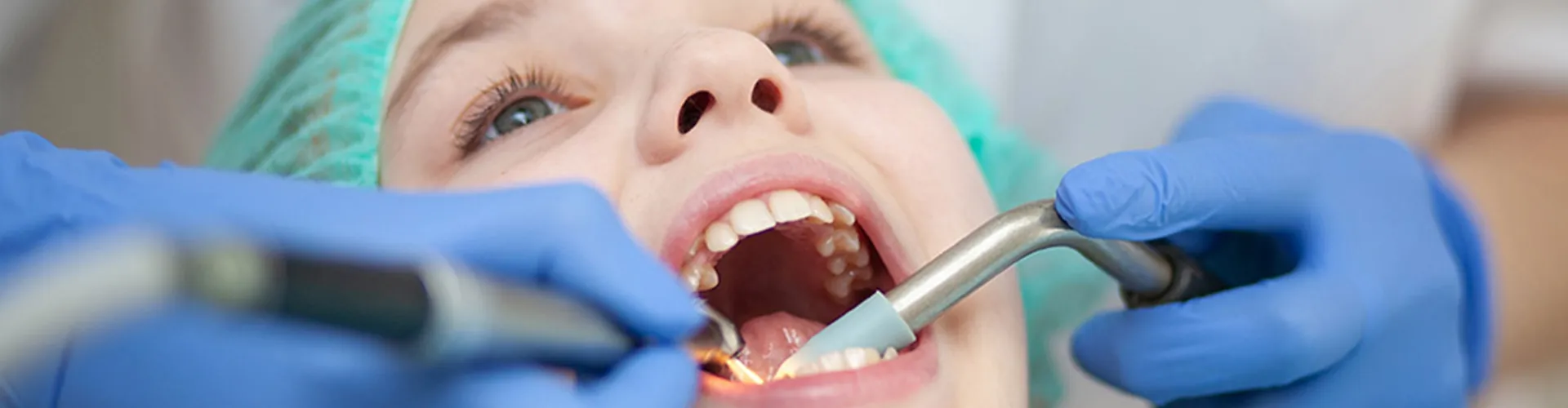 Cavity filling.
