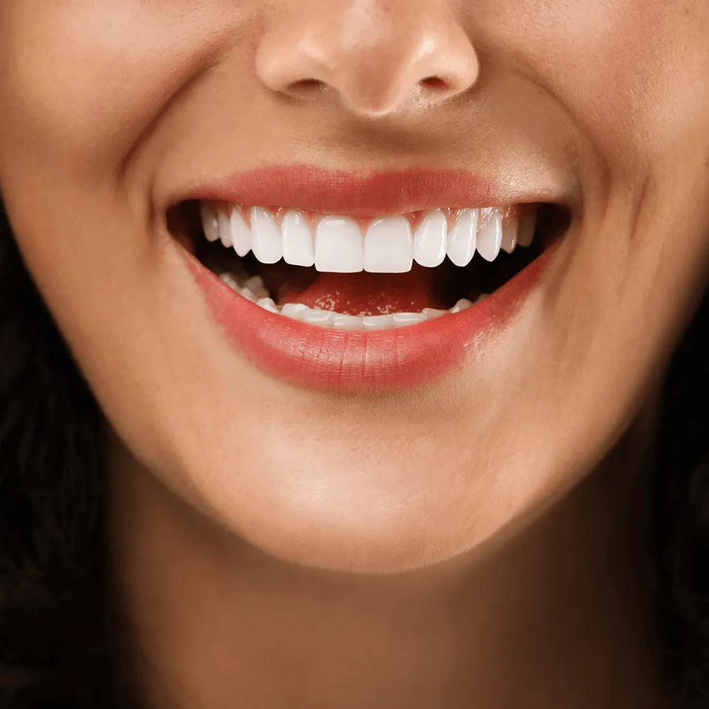 Close-up of a woman's bright, healthy smile with perfectly white teeth.