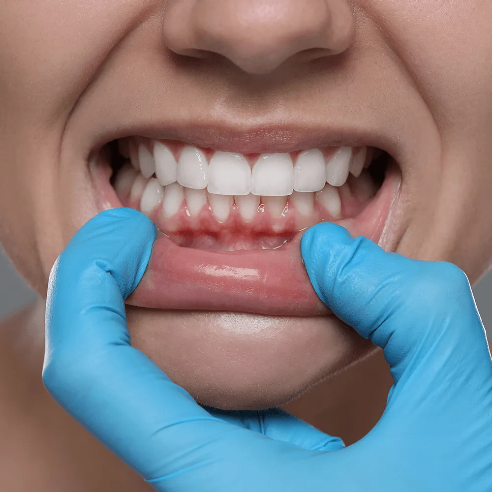 Close-up of dentist's gloved hands examining gums and teeth during a dental checkup.