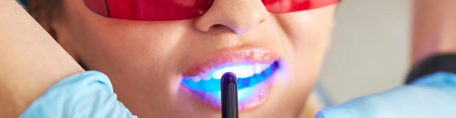Gloved hands shining blue light on teeth of woman wearing orange glasses.
