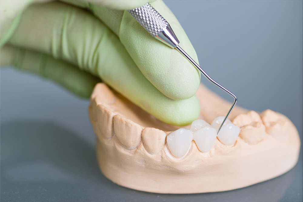 Crowns and Bridges: Restore Your Smile with Complete Health Dentistry of Woodland Hills