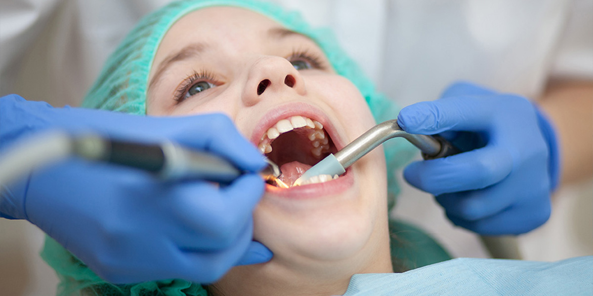 Understanding Dental Cavities: Causes, Prevention, and Treatment