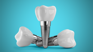 three dental implants with crowns